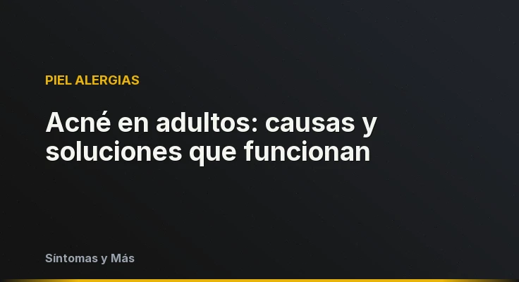 Acné en adultos: causas y soluciones que funcionan
